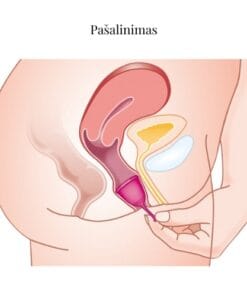 Menstruacines taureles pasalinimas